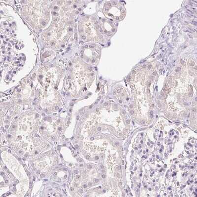 Immunohistochemistry-Paraffin: SYCE2 Antibody [NBP1-90637]