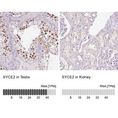 Immunohistochemistry-Paraffin: SYCE2 Antibody [NBP1-90637]