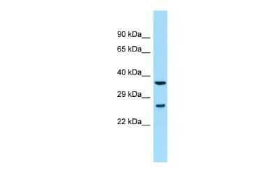 Western Blot: SYCE2 Antibody [NBP2-85849]