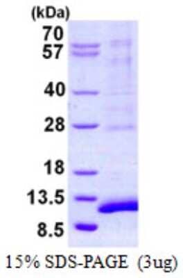 SDS-PAGE: Recombinant Human SYCE3 His Protein [NBP2-22836]