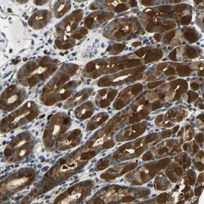 Immunohistochemistry-Paraffin: SYDE1 Antibody [NBP1-89350]