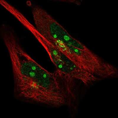 Immunocytochemistry/ Immunofluorescence: SYDE2 Antibody [NBP2-58432]