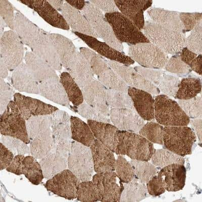 Immunohistochemistry: SYDE2 Antibody [NBP1-94015]