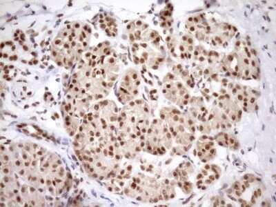 Immunohistochemistry: SYF2 Antibody (OTI6A5) [NBP2-46033]