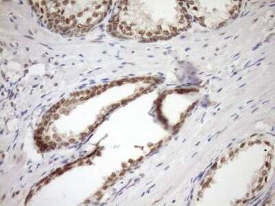 Immunohistochemistry: SYF2 Antibody (OTI6A5) [NBP2-46033]