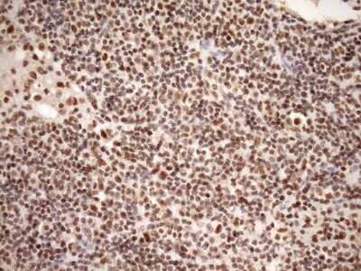 Immunohistochemistry: SYF2 Antibody (OTI6A5) [NBP2-46033]