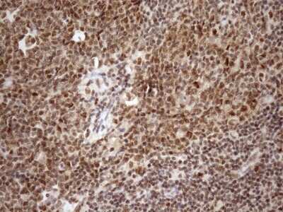 Immunohistochemistry: SYF2 Antibody (OTI6A5) [NBP2-46033]
