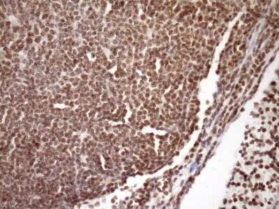 Immunohistochemistry: SYF2 Antibody (OTI6A5) [NBP2-46033]