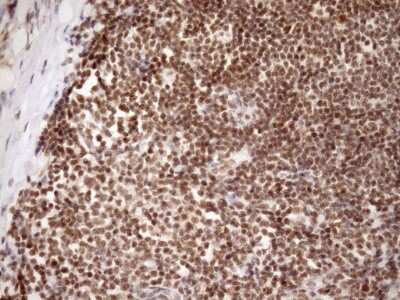 Immunohistochemistry: SYF2 Antibody (OTI6A5) [NBP2-46033]