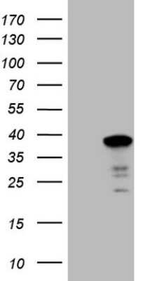 Western Blot: SYF2 Antibody (OTI6A5) [NBP2-46033]