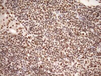 Immunohistochemistry: SYF2 Antibody (OTI6A5) - Azide and BSA Free [NBP2-74413]
