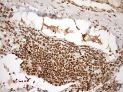 Immunohistochemistry: SYF2 Antibody (OTI6A5) - Azide and BSA Free [NBP2-74413]