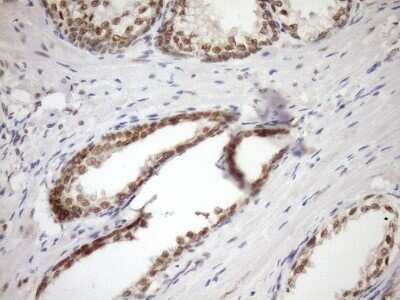 Immunohistochemistry: SYF2 Antibody (OTI6A5) - Azide and BSA Free [NBP2-74413]