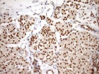 Immunohistochemistry: SYF2 Antibody (OTI6A5) - Azide and BSA Free [NBP2-74413]