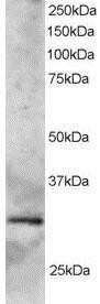 Western Blot: SYF2 Antibody [NB100-1132]