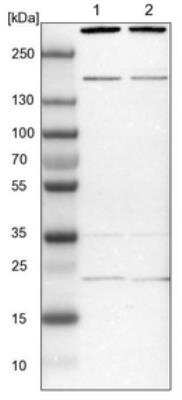 Western Blot: SYF2 Antibody [NBP1-92463]