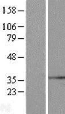 Western Blot: SYF2 Overexpression Lysate [NBL1-16636]