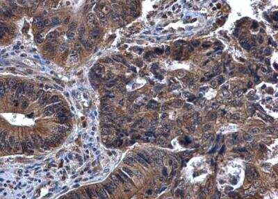 Immunohistochemistry-Paraffin: SYK Antibody [NBP1-32945]