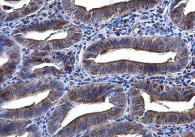 Immunohistochemistry-Paraffin: SYK Antibody [NBP1-32945]