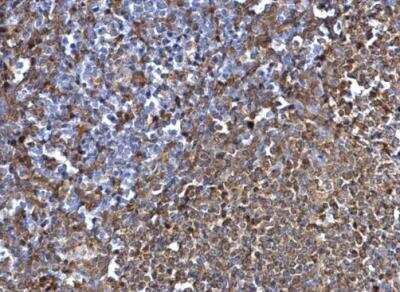Immunohistochemistry-Paraffin: SYK Antibody [NBP1-32945]