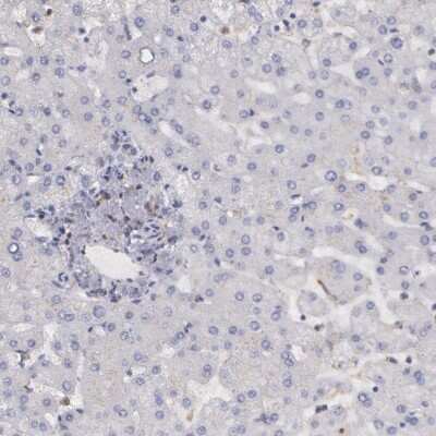 Immunohistochemistry-Paraffin: SYK Antibody [NBP1-86178]