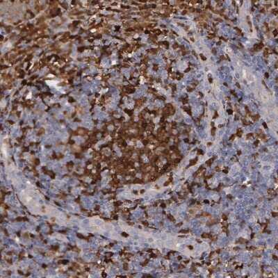 Immunohistochemistry-Paraffin: SYK Antibody [NBP1-86178]