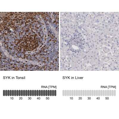 Immunohistochemistry-Paraffin: SYK Antibody [NBP1-86178]