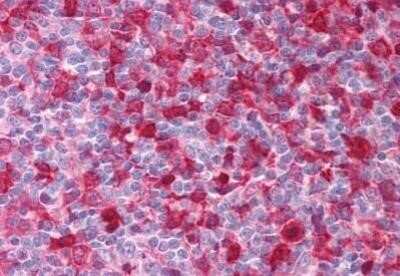 Immunohistochemistry-Paraffin: SYK Antibody (SYK-01) [NBP1-03250]