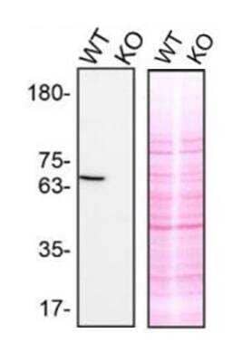 Knockout Validated: SYK Antibody (SYK-01) [NBP1-03250]