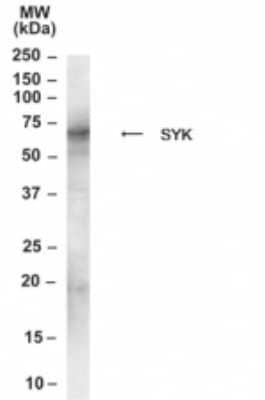 Western Blot: SYK Antibody [NB100-1796]