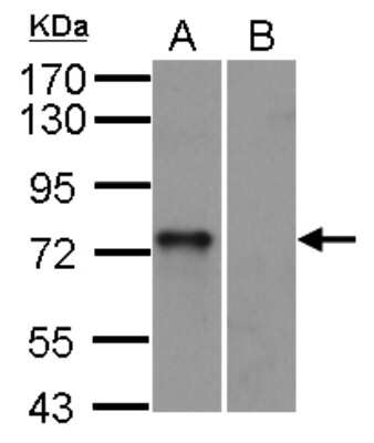 Western Blot: SYK Antibody [NBP1-32945]