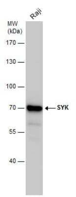 Western Blot: SYK Antibody [NBP1-32945]