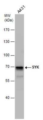 Western Blot: SYK Antibody [NBP1-32945]