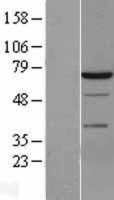 Western Blot: SYK Overexpression Lysate [NBL1-16637]