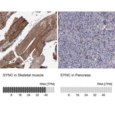 Immunocytochemistry/ Immunofluorescence: SYNC Antibody [NBP3-17067]