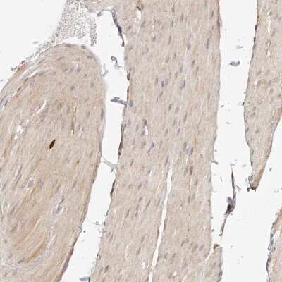 Immunohistochemistry-Paraffin: SYNC Antibody [NBP2-14497]