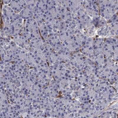 Immunohistochemistry-Paraffin: SYNC Antibody [NBP3-17067]