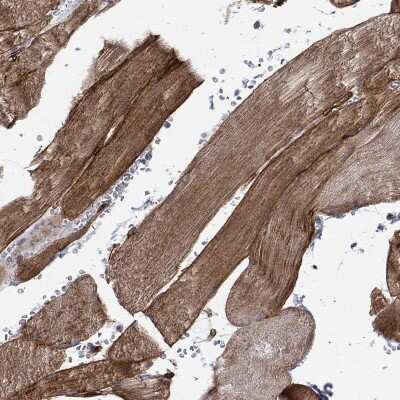 Immunohistochemistry-Paraffin: SYNC Antibody [NBP3-17067]