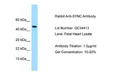 Western Blot: SYNC Antibody [NBP2-85857]