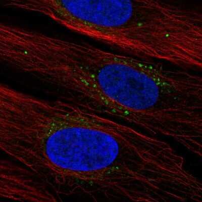 Immunocytochemistry/ Immunofluorescence: SYNDIG1 Antibody [NBP2-68658]