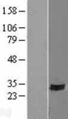 Western Blot: SYNDIG1 Overexpression Lysate [NBL1-08373]