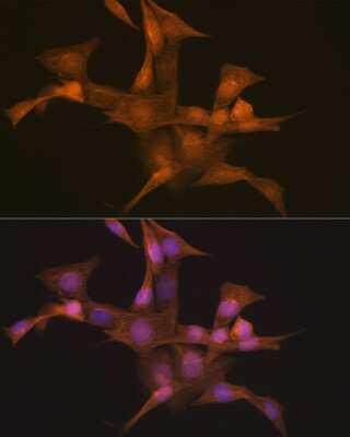 Immunocytochemistry/ Immunofluorescence: SYNE1 Antibody (1D4D9) [NBP3-15911]