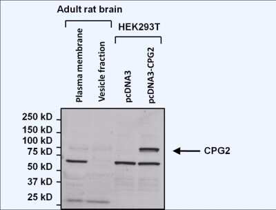 Western Blot: SYNE1 Antibody (6A) [NBP2-22477]