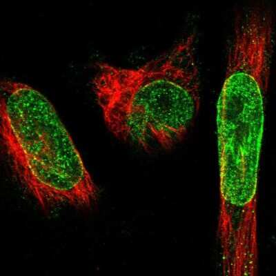 Immunocytochemistry/ Immunofluorescence: SYNE1 Antibody [NBP1-89349]