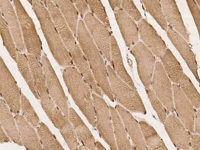 Immunohistochemistry-Paraffin: SYNE1 Antibody [NBP2-98081]