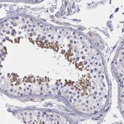 Immunohistochemistry: SYNJ2BP/ARIP2 Antibody [NBP1-88985]