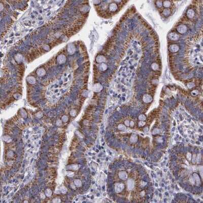 Immunohistochemistry-Paraffin: SYNJ2BP/ARIP2 Antibody [NBP1-88985]