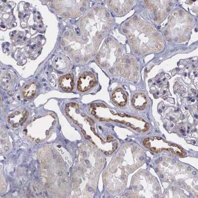 Immunohistochemistry-Paraffin: SYNJ2BP/ARIP2 Antibody [NBP1-88985]