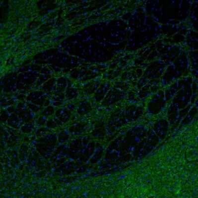 Immunohistochemistry-Paraffin: SYNJ2BP/ARIP2 Antibody [NBP1-88985]