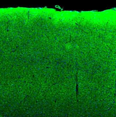Immunohistochemistry-Paraffin: SYNJ2BP/ARIP2 Antibody [NBP1-88985]